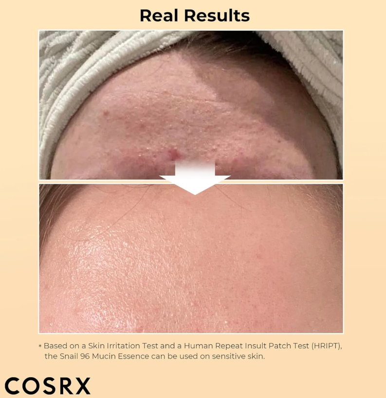 Cosrx - Advanced Snail 96 Mucin Power Essence 30 ml