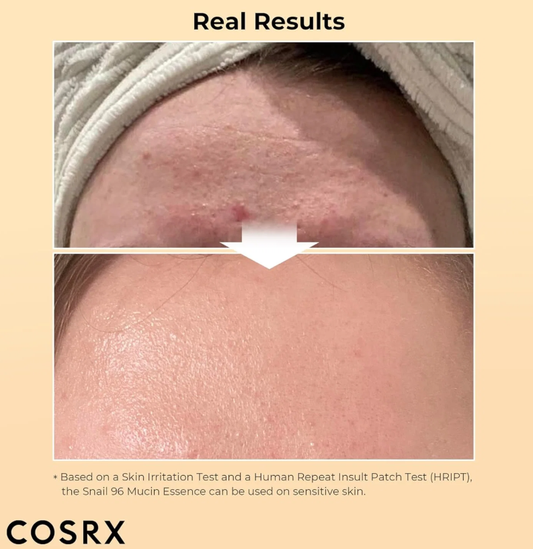 Cosrx - Advanced Snail 96 Mucin Power Essence 30 ml