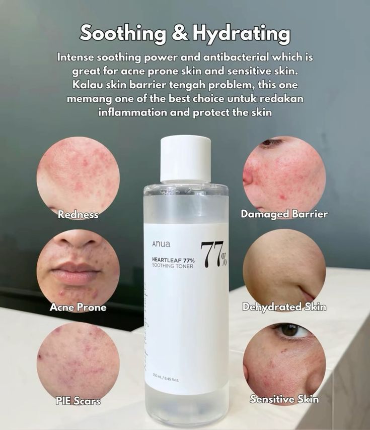 Anua Heartleaf 77% Soothing Toner 250Ml