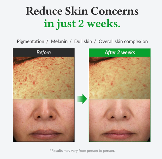 Dr.Althea Gentle Vitamin C Serum