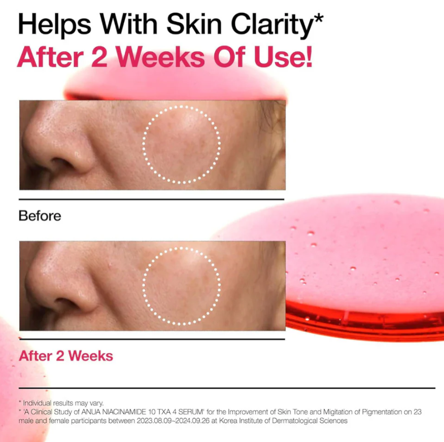 Anua Niacinamide 10% + TXA 3%