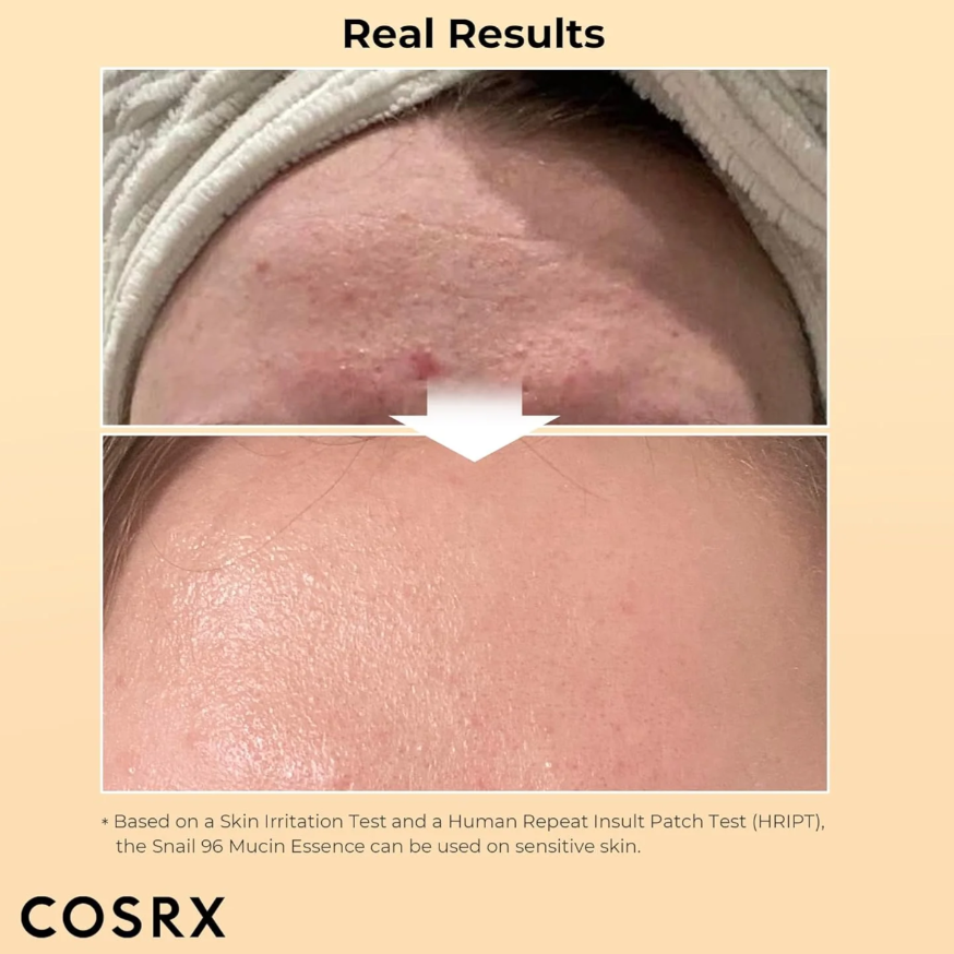 Cosrx - Advanced Snail 96 Mucin Power Essence 100 ml